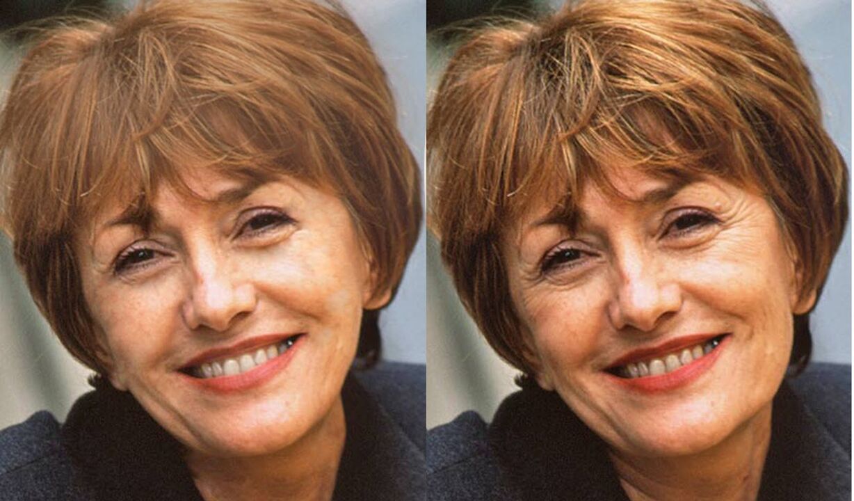 foto del viso prima e dopo il contouring